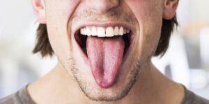 Как почистить язык от желтого налета